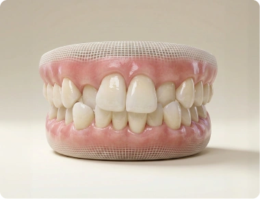 Exemplo de apinhamento dentário.